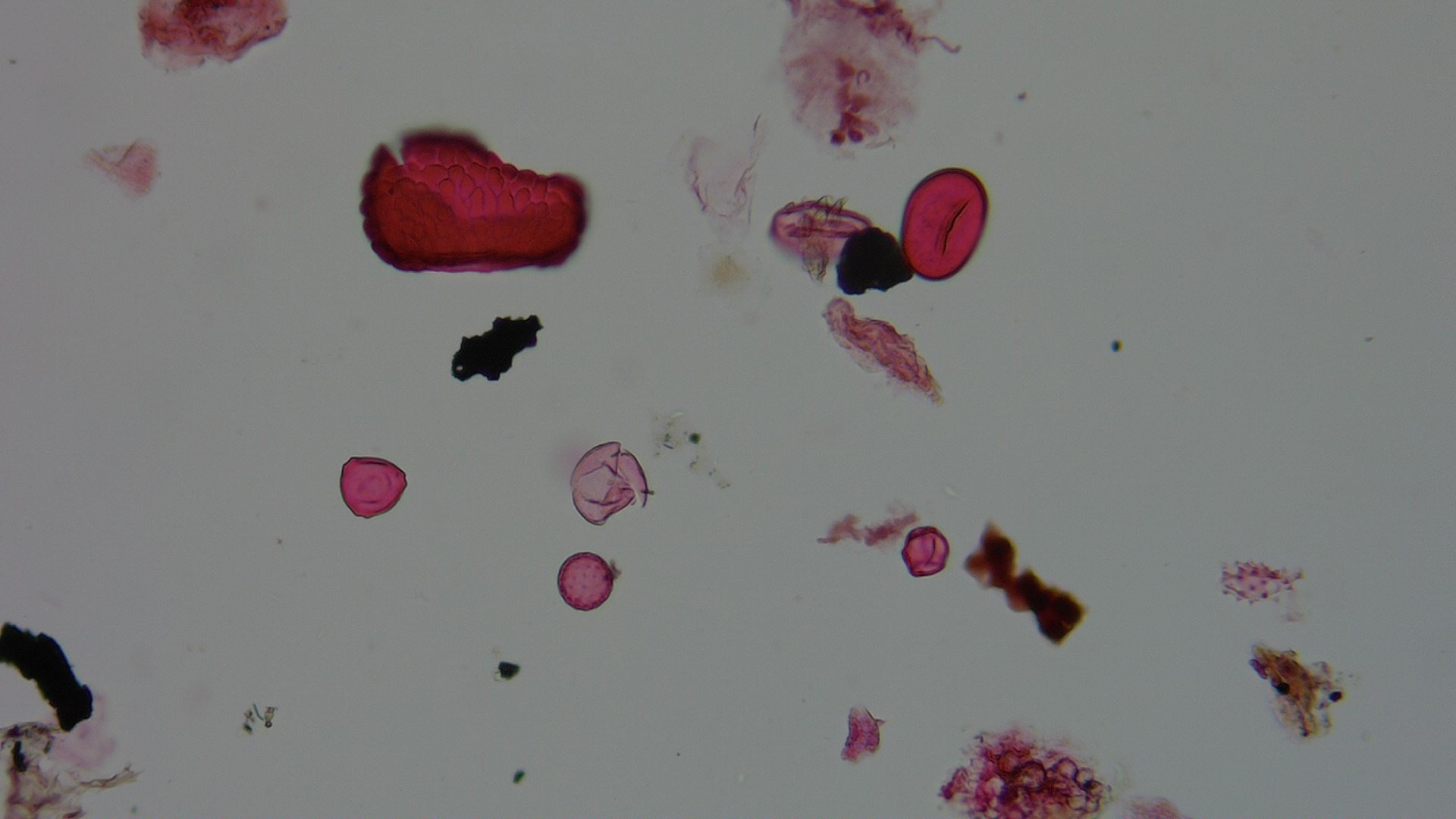 Pollen microscope slide BH37-19.72b