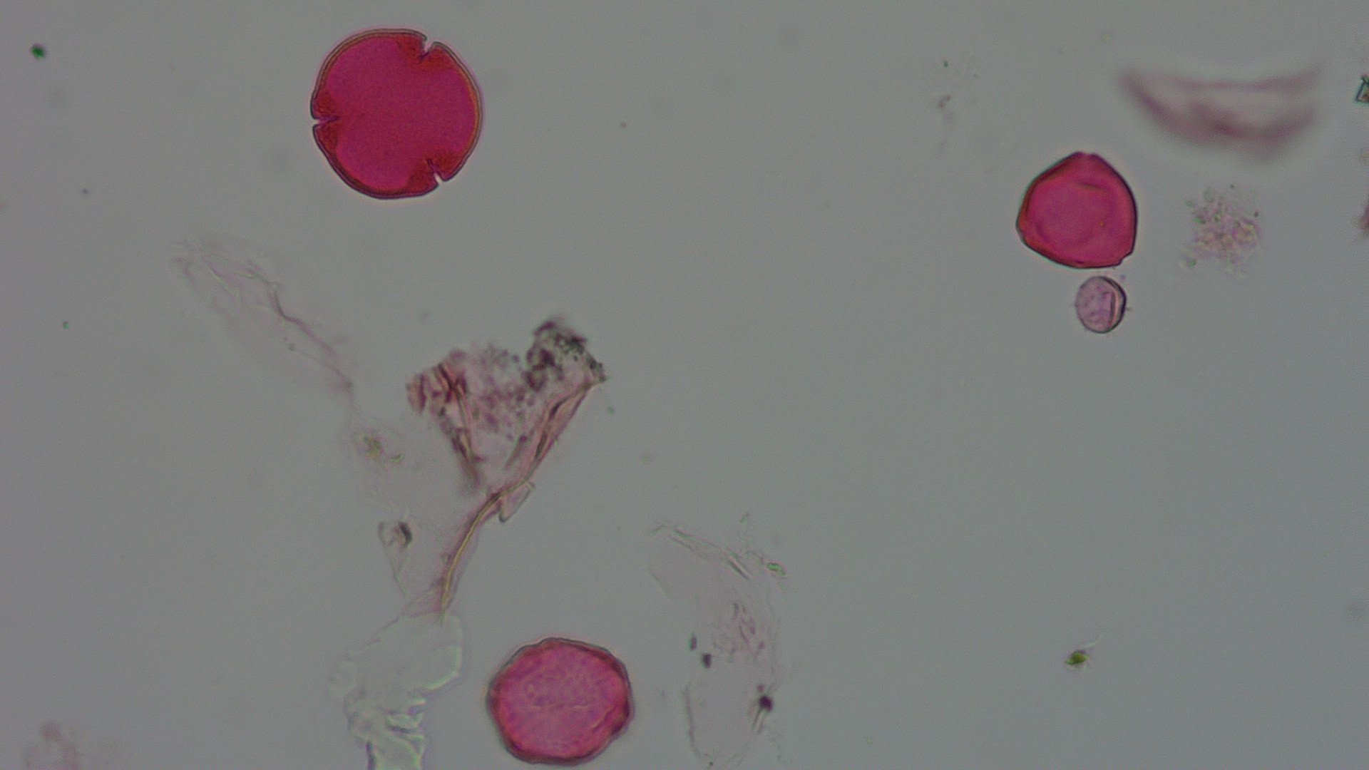 Pollen microscope slide BH37-19.72d