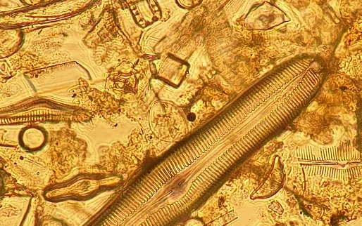 Diatom analysis