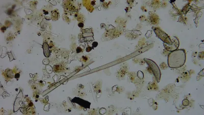 Diatom microscope slide 003-1.50a