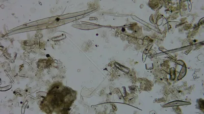 Diatom microscope slide 051-1.51a