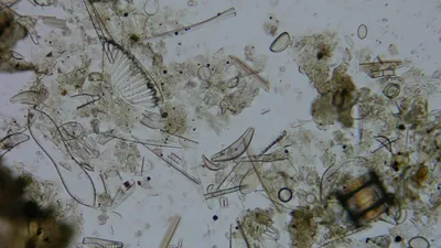 Diatom microscope slide 051-1.51b