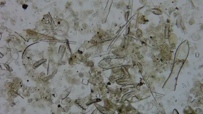 Diatom microscope slide 051-1.51c
