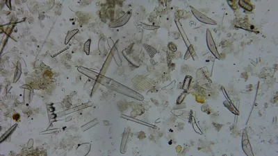 Diatom microscope slide 051-1.51d