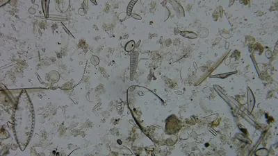 Diatom microscope slide 051-1.51e