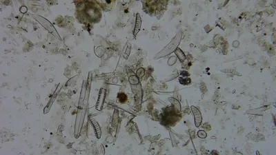 Diatom microscope slide 051-1.51f