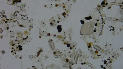 Diatom microscope slide 054-0.91d