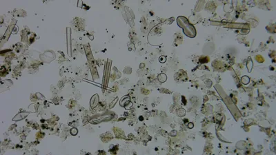 Diatom microscope slide 054-1.82a