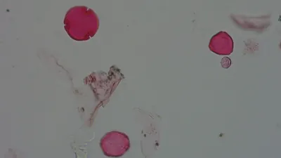 Pollen microscope slide BH37-19.72d