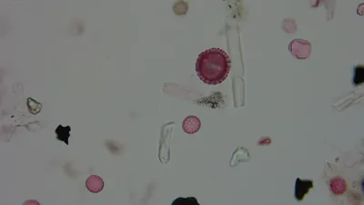 Pollen microscope slide BH47-2.04a