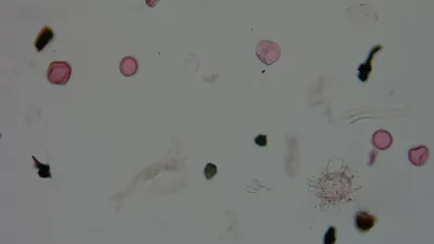Pollen microscope slide BH47-2.04b